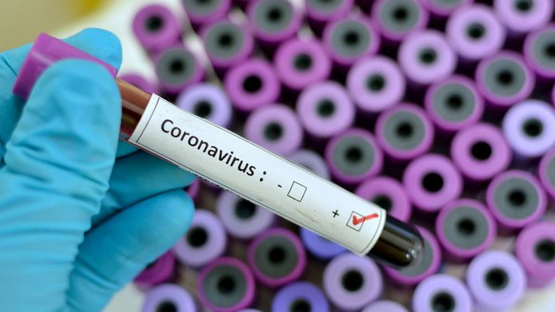 COVID-19: Ghana’s 566 case count highest in West Africa