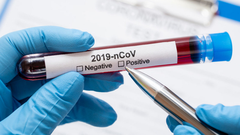 COVID-19 cases in Ghana move up to 3,091