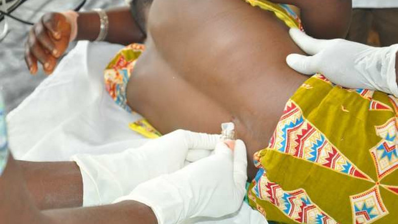 CSM cases move up to 315 with 45 deaths