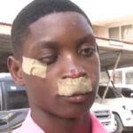 Student Assaulted at Agona Swedru Inter-Schools Athletics event speaks