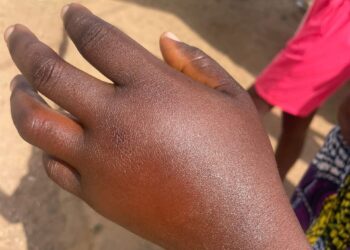 C/R: Three-Year-Old Boy dies in Bee attack at Agona Swedru