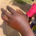 C/R: Three-Year-Old Boy dies in Bee attack at Agona Swedru